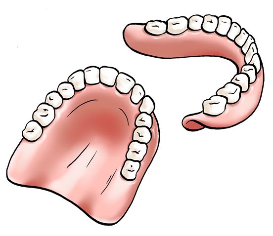 Helprotese illustration